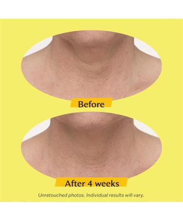 StriVectin TL Advanced Tightening Neck Cream PLUS 0.25 fl oz for Tightening and Firming Neck & D collet Lines Tighten & Lift Advanced Neck Cream Plus .25 fl oz - Buy Online on GoSupps.com