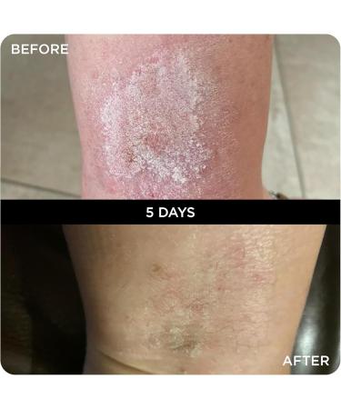 WONDERBALM LIMITED Multi Use Balm All in One Skin Cream Moisturizer for Hair Cuticles Lips and Body Moisturizing Fast Absorbing NonGreasy Olive Oil Shea Butter Vegan Natural Ingredients 20 ml - Buy Online on GoSupps.com