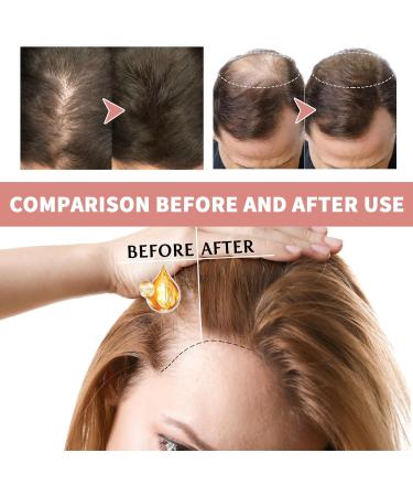 Shantou Yingji Volumizing hair strengtheners Intensive treatment for fall and thinning with tocopherol regenerating serum for hair growth and strength serum for damaged and dry hair 2 ml x 7 pieces - Buy Online on GoSupps.com