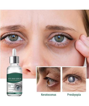 Eye Drops - Eye Repairing Presbyopia Drop | Refreshing Eyies Fatigue Relief | Nano Eyie Droips Suitable For Vision Support Dryness Reilief & Daily Eiyes - Buy Online on GoSupps.com
