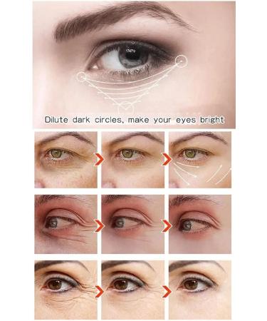 EXQST Caviar Repair Essence Eye Cream Tightening and Lifting Caviar Eye Cream Caviar Collagen Luxury Eye Lift Cream AntiWrinkle Eye Cream for Dark Circles and Puffiness - Buy Online on GoSupps.com