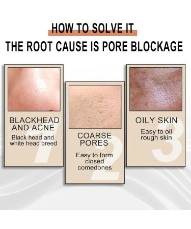 5 PCs Lactobionic Acid Pore Tannerization Oil - Gentle 30ml Facial Pore Shrinking Solution for Perfect Skin - Instant Results by Fulenyi - Buy Online on GoSupps.com