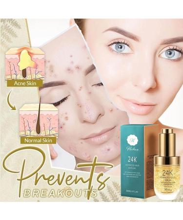 24k Gold Face Serum with Hyaluronic Acid, Vitamin E & C | Brightens, Firms, and Treats Acne | Anti-Aging & Anti-Wrinkles | For All Skin Types | Day & Night Use - Buy Online on GoSupps.com