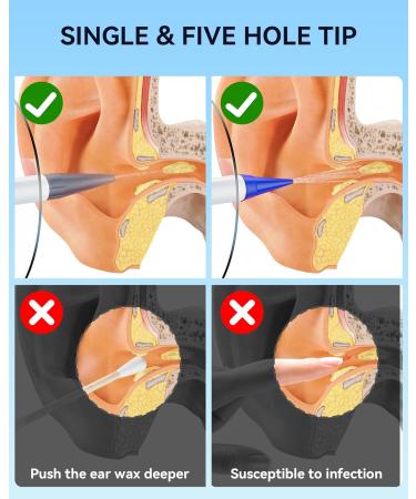 Electric Ear Wax Removal with 1080P Ear Camera Water Powered Ear Cleaner with 4 Mode Settings 10 Tips Wireless Otoscope with 6 LED Lights 8 PCS Earwax Removal Kit Set - Buy Online on GoSupps.com
