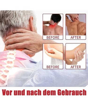 New Zealand Bee Venom Joint Cream - Pain Relief for Back Ankle Joint & Muscle Discomfort | Bienengift Salbe - Buy Online on GoSupps.com