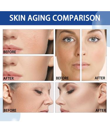 10% Niacinamide Serum + 1% Zinc Serum for Blemish-Prone Skin - Moisturizing and Oil-Control Face Serum | Brightening Formula to Minimize Pores and Redness - 1PCS - Buy Online on GoSupps.com