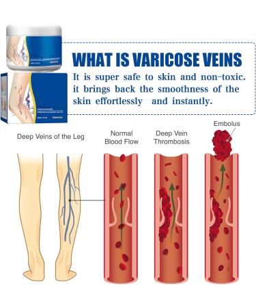 VKaoess Soothing and moisturizing leg cream gel-cream for dry skin light and non-greasy moisturizing care daily moisturizing cream helps maintain skin hydration (3 boxes) - Buy Online on GoSupps.com