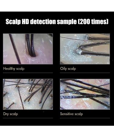 Skin Hair Analyzer Hair Scalp Detector with 14.1-inch Screen and 10 Million Pixels Lens 50x/200x Amplification Probes and Detecting Skin Hair Follicles Clearly for Beauty Salon Spa Center - Buy Online on GoSupps.com