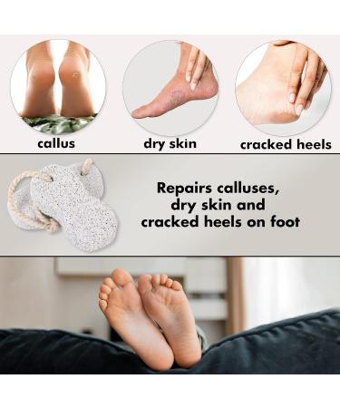 Jairestone Natural Earth Lava Pumice Stone for Feet - Foot Callus Remover - Shower Foot Scrubber - Pack of 2 - Buy Online on GoSupps.com