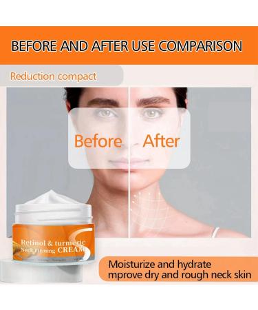 Turmeric Neck Firming Cream Natural AntiAging Neck Cream Neck Tightening Cream for Women Neck Cream for Sagging and Tightening Turmeric Lifting Neck Cream Hydrating Turmeric Cream Smoothing Neck Cream - Buy Online on GoSupps.com