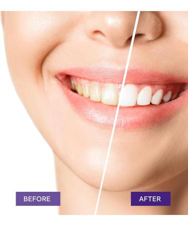 Purple Teeth Whitening Toothpaste - Effective Whitening for Adults | 1fl oz - Buy Online on GoSupps.com