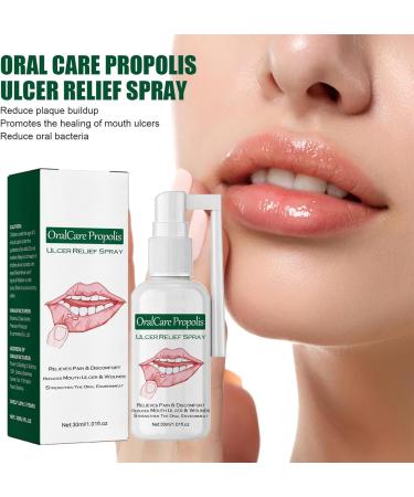 Mouth Ulcer Treatment Spray 30ml Mouth Ulcer Spray OralCare Propolis Ulcer Relief Spray for Wound Protection & Relief Canker Sore Treatment Herbal Mouth Spray Breath Spray for Bad Breath (2Pcs) - Buy Online on GoSupps.com