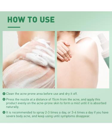 Back Acne Treatment Spray With Herbal Formula 2% Salicylic Acid & Tea Tree Oil - Body Acne Solution 120ml 1PCS - Buy Online on GoSupps.com