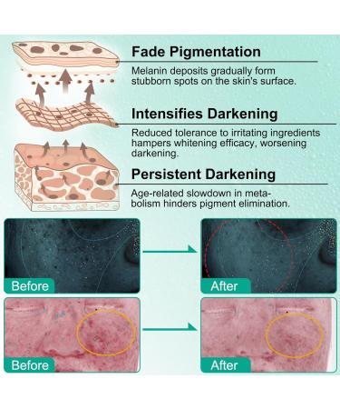 Dark Spot Correcting Glow Serum Korean Dark Spot Correction Serum Skincare Glow Intense Eclaircissant Anti-Stain Cream With Retinol And Hyaluronic Acid Lightening Cream (1) - Buy Online on GoSupps.com