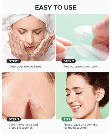 Hydrocolloid Acne Pimple Patch | 144 Fast Healing Spot Stickers for Zits & Blemishes | Vegan & Cruelty-Free Skin Care - Buy Online on GoSupps.com