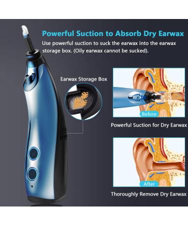 Rotatable Ear Wax Vacuum Cleaner with Suction | Electric Ear Cleaning Massage Kit for Adults & Kids - Denim Blue - Buy Online on GoSupps.com