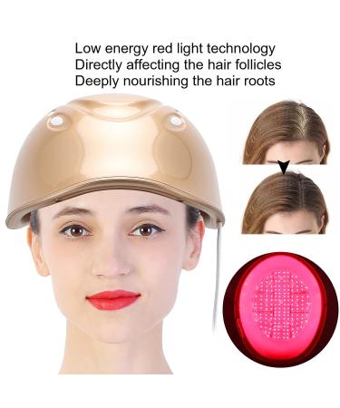 Hair Growth Device - 160 Light Chips Hair Loss Treatment for Men & Women | Gold Restoration System (EU) - Buy Online on GoSupps.com