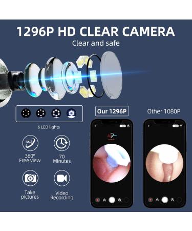 Wireless HD Ear Wax Removal Camera with 8 Cleaner Kit - Black-YY10 - Buy Online on GoSupps.com