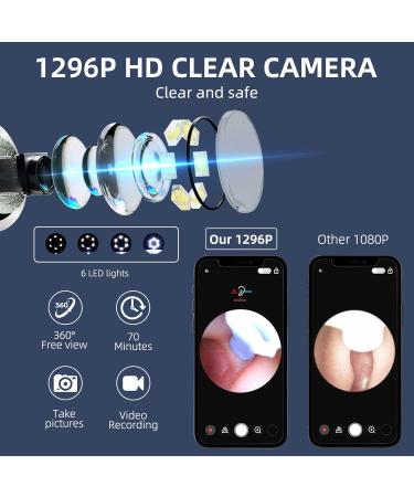 AVM Ear Wax Removal Camera HD 1296p - Wireless Ear Cleaning Tool with 8 Earwax Cleaner Kit for Kids Adults & Pets - Compatible with iPhone & Android - YY10ERB - Buy Online on GoSupps.com