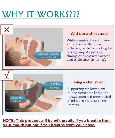 WAKI HOME Anti Snoring Chin Strap - Adjustable Stop Snoring Solution for Men and Women | Snore Stopper Jaw Strap for Better Sleep - Buy Online on GoSupps.com