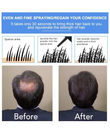 Aliver Hair Fiber Applicator Pump Spray Nozzle | Optimize Hair Building Fibers for Thinning Hair | Precision Application & Even Distribution | Black - Buy Online on GoSupps.com