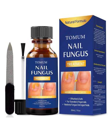 Toenail fungus treatment Nail Fungus Treatment for Toenail Toe Nail Fungus Treatment Extra Strength Effective Fingernail and Toenail Fungus Killer Nail Repair Solution Restoring Healthy Nails
