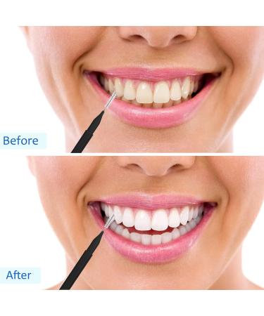 Patelai 100-Piece Interdental Brushes - Ultimate Dental Hygiene Tool for Flossing & Cleaning | Black Toothpick Cleaners - Buy Online on GoSupps.com