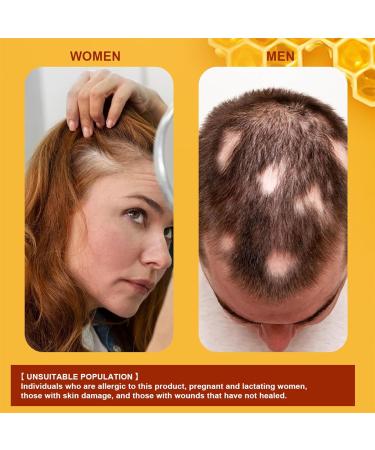 Cr me de croissance des cheveux engrais pour stimuler la croissance des cheveux produit de traitement nourrissant pour le cuir chevelu pour renforcer les cheveux pour hommes et femmes - Buy Online on GoSupps.com