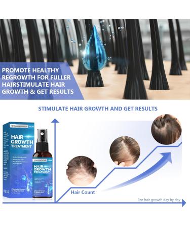 Hair Growth Spray Thicker and Longer Hair Regrowth Serum 2- Month Supply Suitable for Men and Women 60mL - Buy Online on GoSupps.com