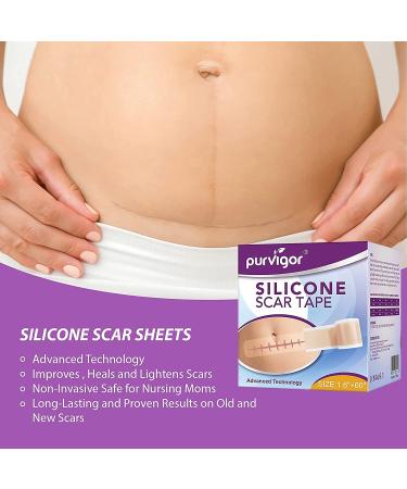 Medical Grade Silicone Scar Sheets - 1.6 x 60 Reusable Gel Tape for Acne, C-Section, Keloid Surgery Scars Treatment - Buy Online on GoSupps.com