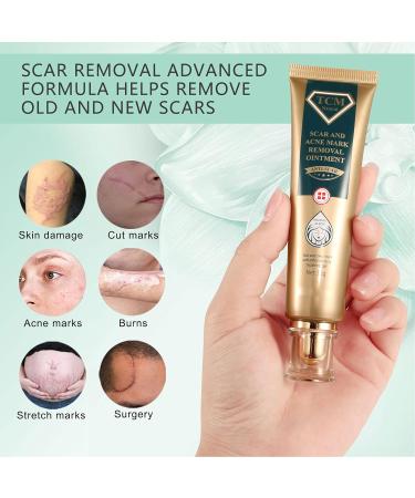 Scar Removal Cream - 30g - Fade Scars, Stretch Marks & Burns - Moisturizing Facial Skin Repair Treatment - Buy Online on GoSupps.com