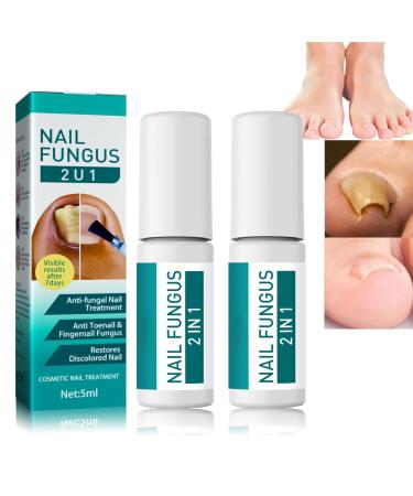 Fungal Nail Treatment For Toenails Extra Strong-Nail Fungus Treatment Toenail-Natural Anti Fungal Nail Treatment Fungal Nail Polish For Finger&Toe Nail Fungal Treatment (Nail Fungal 2 IN 1 X 2pcs)
