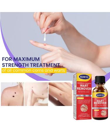 Wart Remover Liquid | Maximum Strength Gel Mask for Plantar & Common Warts | Safe & Natural Formula - Buy Online on GoSupps.com