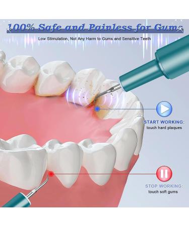 Premium Tooth Cleaning Set - Tartar Remover with 4 Modes & 4 Heads | Home Dental Care IPX6 Waterproof - Buy Online on GoSupps.com