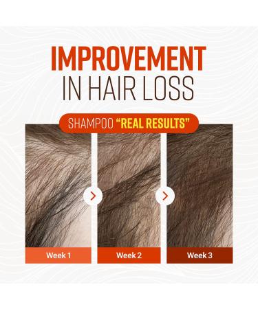 Crazy Skin Beer Yeast Hair Shampoo 300g - Nourishing Formula for Strong, Healthy Hair - Buy Online on GoSupps.com