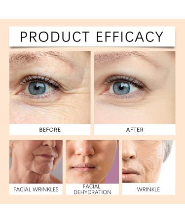 10 hyaluronic serum 30 ml facial care for men and women hyaluronic acid serum for the face with antiwrinkle active ingredients hyaluronic acid facial serum moisturizing serum - Buy Online on GoSupps.com