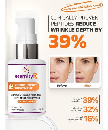 Retinol Night Cream with Vitamin A Matrixyl 3000 Vitamin C & Daisy Extract Anti-Aging Night Treatment for Fine Lines Skin Tone & Wrinkles Non-Irritating by Eternity Medicine 1oz - Buy Online on GoSupps.com