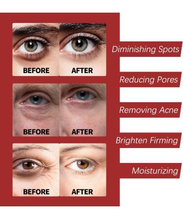  Beslibate Retinol Face Cream Retinol Moisturizing Cream for Facial Wrinkles for Dry and Dull Skin Retinol Cream for Nighttime Beauty for All Skin Types 2PC *30g Cream - Buy Online on GoSupps.com