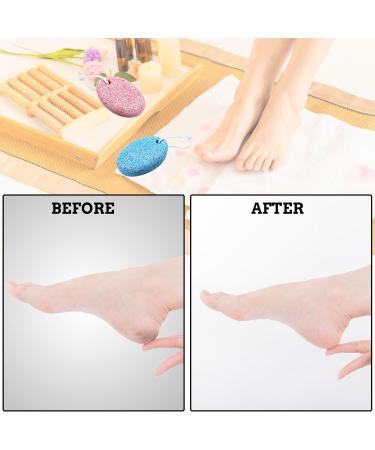 2Pcs Pumice Stone for Foot Polishing Stone for Feet Exfoliates Stone for Foot Feet Scrubber Foot Pumice Stone - Pink & Blue - Buy Online on GoSupps.com