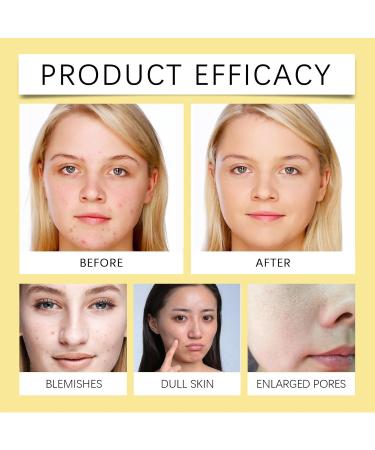 Niacinamide Facial Wash Women Whitening & Cleansing Milk Deep Pore Cleanser Facial Cleanser with Niacinamide Soothing Skin Facial Wash for Deep Cleansing Removes Dirt & Oil without Irritation - Buy Online on GoSupps.com