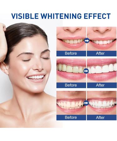 Teeth Whitening Pen (2 Packs) Natural Gel Treatment - Safe, Effective, Painless Whitener - Removes Years of Stains - Travel-Friendly - Buy Online on GoSupps.com
