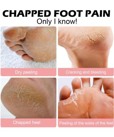 Cracked Heel Repair Cream Stick Foot Moisturizing Stick Foot Cream For Very Dry Feet Foot Cream For Calluses And Hard Skin Foot Moisturiser Callus Remover Soften For Feet Knees Hand - Buy Online on GoSupps.com