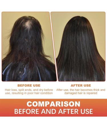 Batana Oil for Hair Growth - 100% Natural Repair Damaged Hair Nourishes Thin Hair Scalp Skin and Loss Hair Growth Fir for All Hair Types Miracle Oil for Thicker Fuller Hair - Buy Online on GoSupps.com