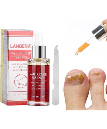 Nail Repair Essence 15ML Nail Fungus Treatment Natural Nail Care Toe Nail Fungus Treatment for Damaged Discolored Nails Antifungus Nail Treatment - Buy Online on GoSupps.com