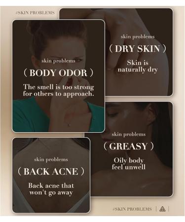 Natural Milk Soap - Ceramide Soap Bar - Dark Spot Remover for Face Soap Bar - Moisture Hydrate Skin Smooth Tender Plump - Clean Pore Dirt Reduce Dryness - Firm Lift Restore Elasticity Complexion Tone - Buy Online on GoSupps.com