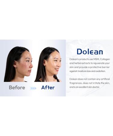 Face Moisturizer | Daily Anti-Aging Cream for Acne & Wrinkles | Hydrating Skin Care Solution 1.7 oz - Buy Online on GoSupps.com