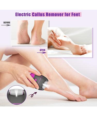 LINGSFIRE Electric Callus Remover for Feet - Rechargeable Foot File with 3 Grinding Rollers | 2 Speeds, Professional Pedicure Tool for Thick, Cracked Skin - Buy Online on GoSupps.com