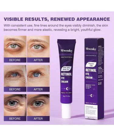 Retinol Eye Cream Infused with Vitamin C&E to Smooth and Hydrate Skin Cream for Dark Circles Treatments Reduce Under Smooth Wrinkles Eye Bags Puffiness - Buy Online on GoSupps.com