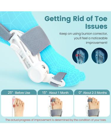 Bunion Corrector for Men & Women | Adjustable Big Toe Splint & Straightener with Silicone Pad - Perfect for Bunions Left/Right Feet - Buy Online on GoSupps.com