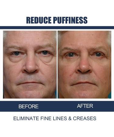 3-Piece Eye Care Set: Peptide Lifting & Depuffing Gel, Moisturizing Cream for Men - Reduce Dark Circles, Lifts & Firms Skin - Buy Online on GoSupps.com